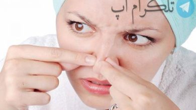 اینفوگرافیک| چگونه از شر جوش های سرسیاه خلاص شویم؟ – تلگرام آپ