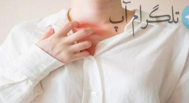 اینفوگرافیک/پیشگیری عرق سوز+کمک های اولیه – تلگرام آپ
