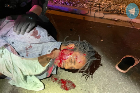 حمله نژادپرستانه به راننده سیاه‌پوست و لبخند پلیس آمریکا + عکس – تلگرام آپ