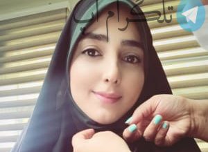 راز و روش زیبایی پوست صورت ستاره قطبی لو رفت – تلگرام آپ