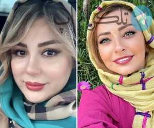 چند بازیگر زن ایرانی کتک خوردند !! عکسشان منتشر شد – تلگرام آپ