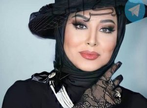 آشا محرابی چه عمل زیبایی کرده؟ + عکس قبل و بعد – تلگرام آپ