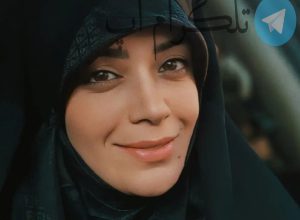 عمل زیبایی الهام چرخنده چی بوده؟ + عکس – تلگرام آپ