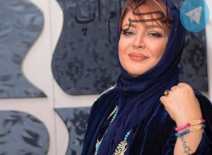 جراحی زیبایی که بین بازیگران ایرانی خیلی مٌد شده – تلگرام آپ