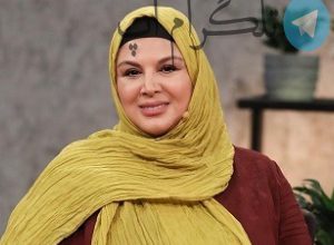 چهره زیبای شهره سلطانی قبل از عمل بینی – تلگرام آپ