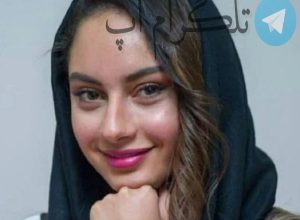 عکس خیلی متفاوت ترلان پروانه بعد عمل زیبایی ؟! – تلگرام آپ