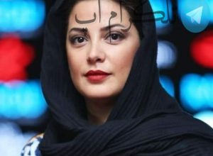 تغییر چهره طناز طباطبایی بعد سریال میوه ممنوعه – تلگرام آپ