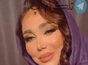 عکس تازه رو شده از چهره بهنوش بختیاری قبل عمل – تلگرام آپ