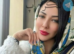 پشت پرده عکس جنجالی لیلا اوتادی فاش شد – تلگرام آپ